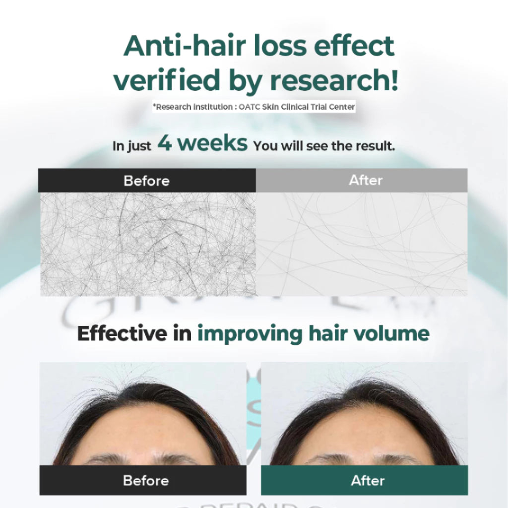 [READY STOCK] GRAFEN Root Booster Shampoo Anti-Hairloss 500ml
